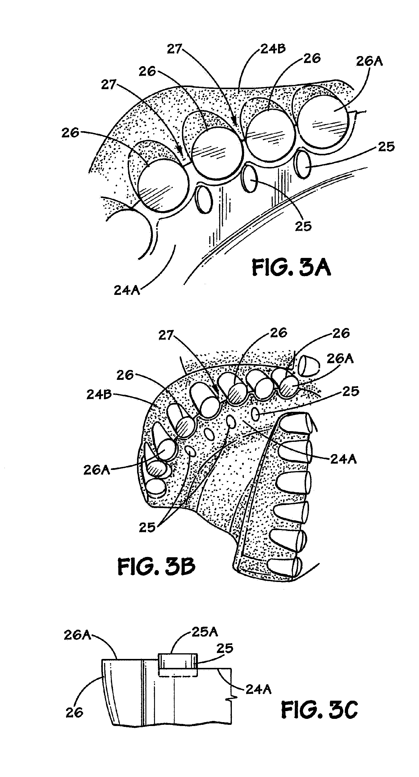 Fixed cutter drill bit with non-cutting erosion resistant inserts