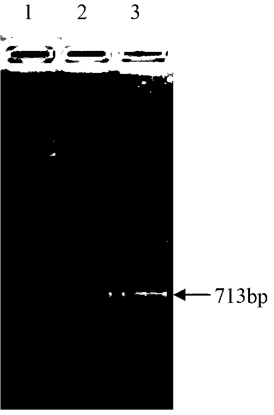 Gametophyte antigen gam22 gene of Eimeria necatrix and application of gene