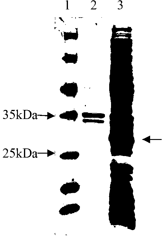 Gametophyte antigen gam22 gene of Eimeria necatrix and application of gene