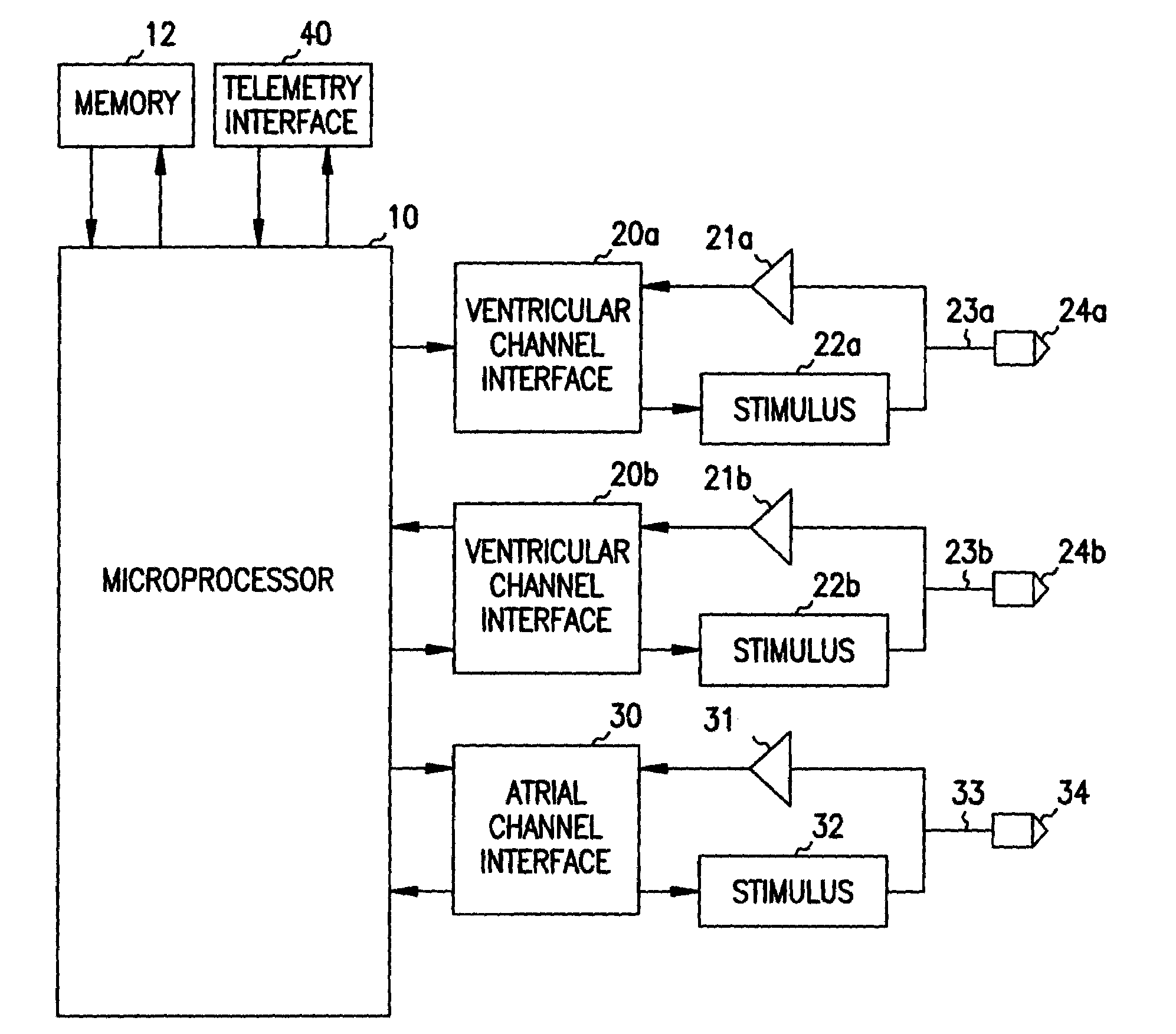 Apparatus and method for spatially and temporally distributing cardiac electrical stimulation