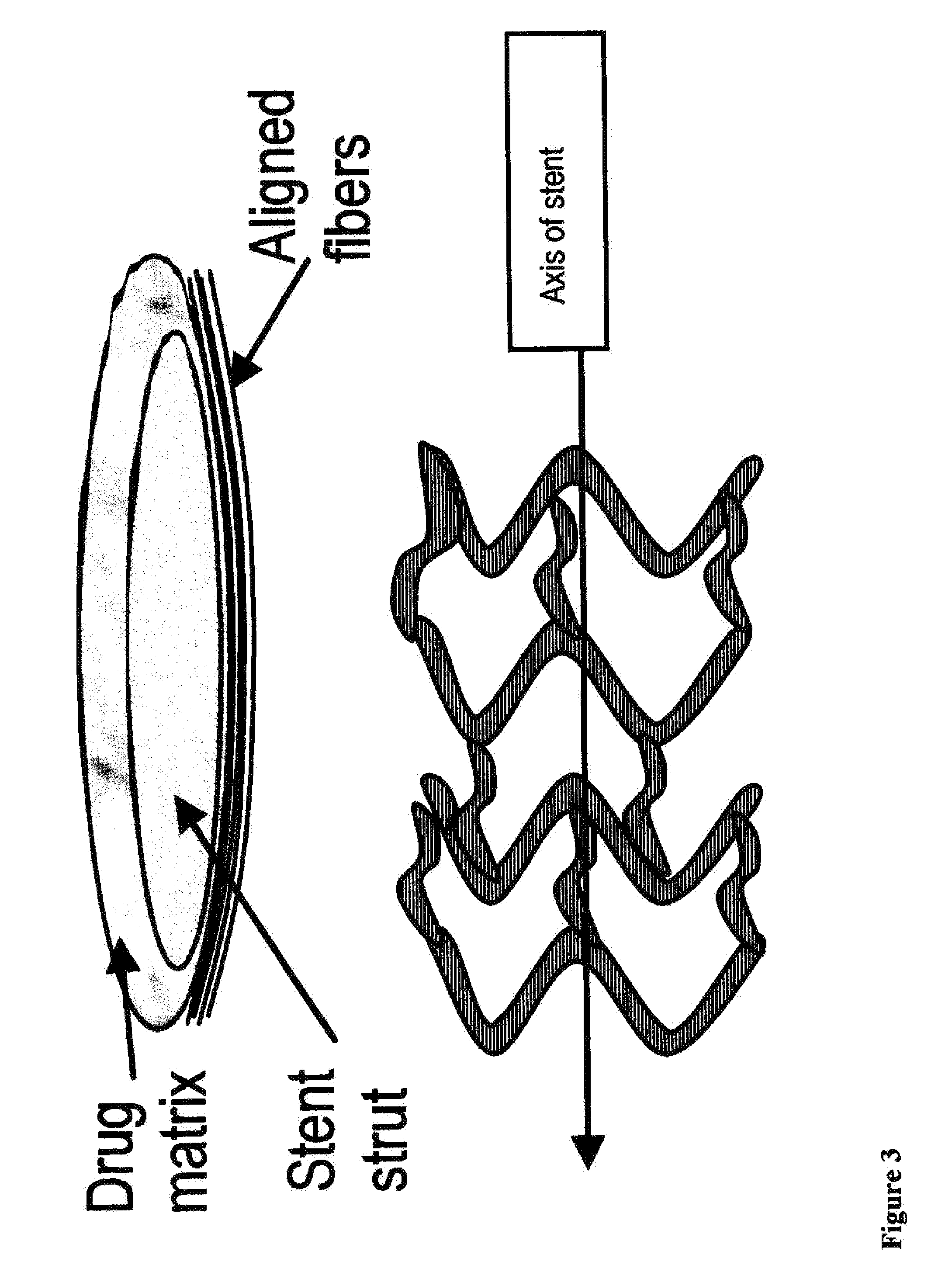 Extracellular matrix modulating coatings for medical devices