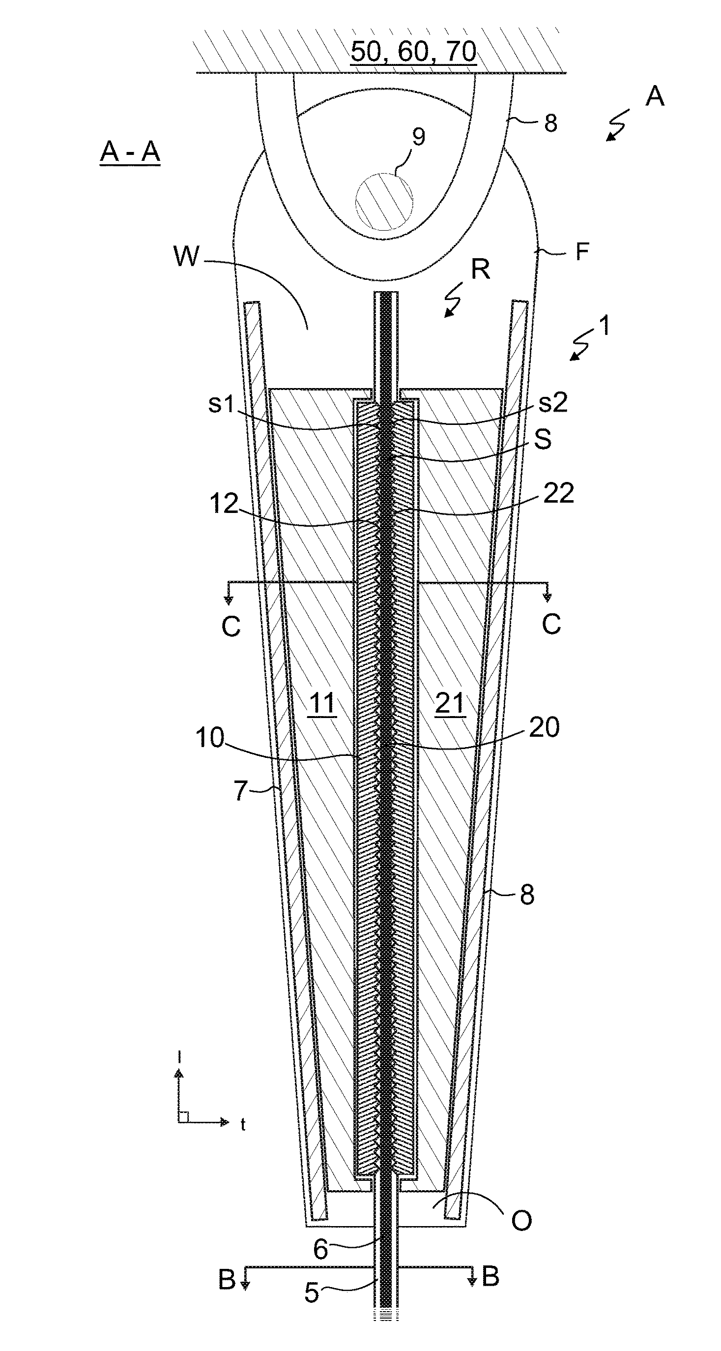 Method, a rope terminal arrangement and an elevator