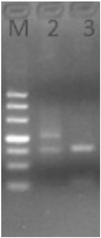 Detection kit for guiding warfarin dosage with high precision and detection method thereof