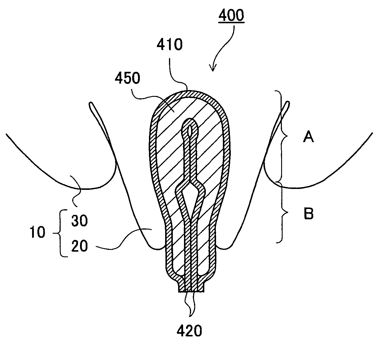 Interlabial pad