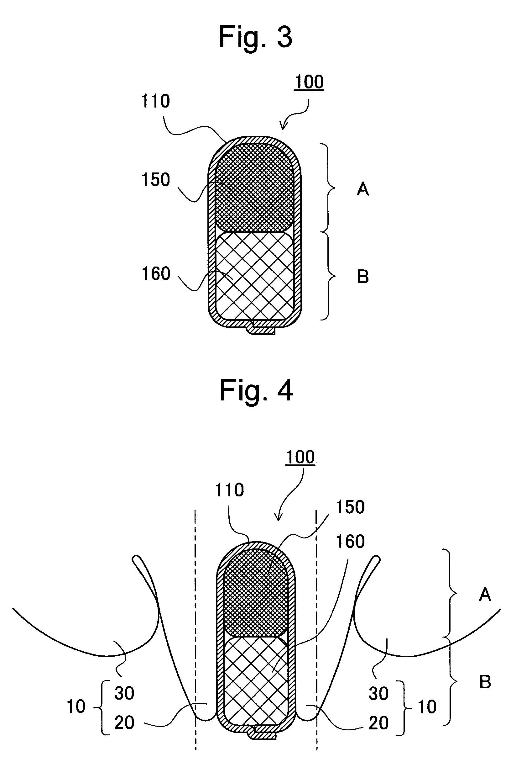 Interlabial pad