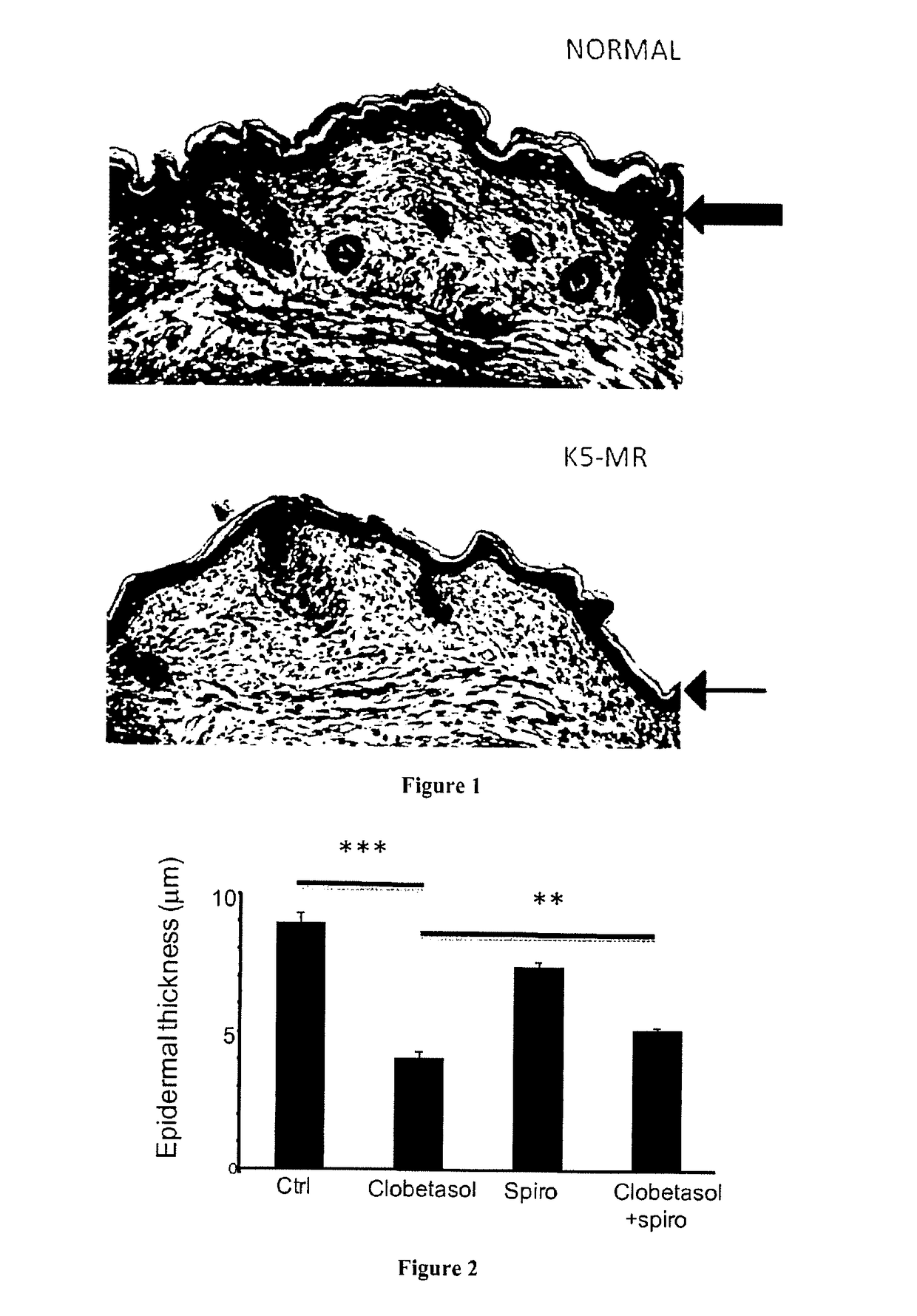 Pharmaceutical compositions for preventing glucocorticoid-induced corneal or skin thinning