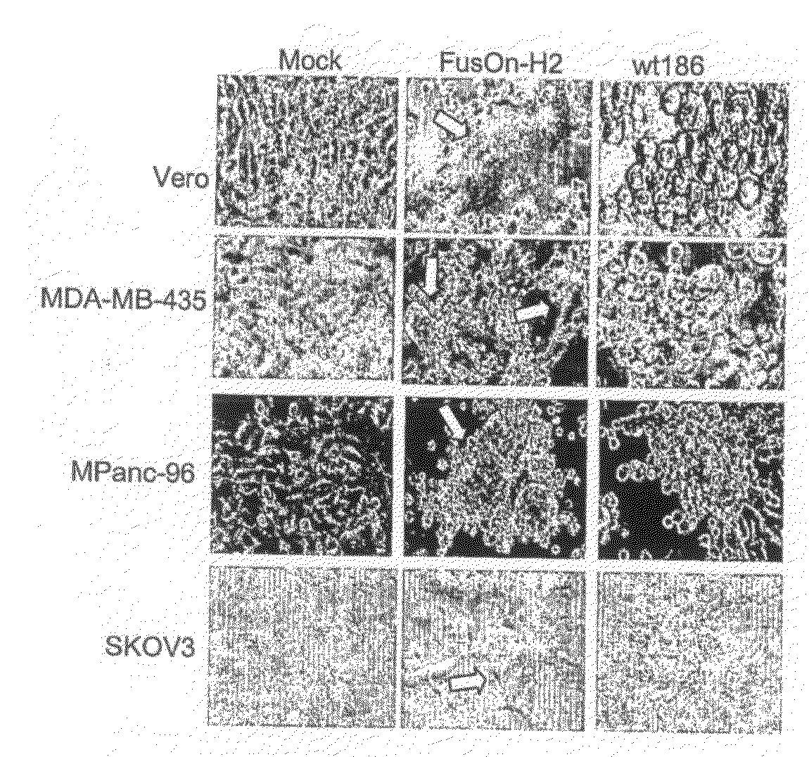 Use of Mutant Herpes Simplex Virus-2 for Cancer Therapy