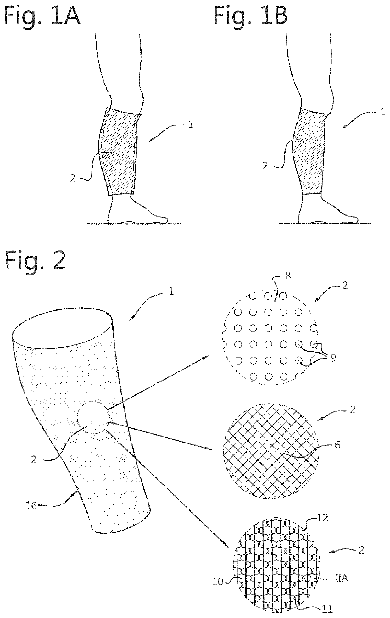 An improved compression stocking