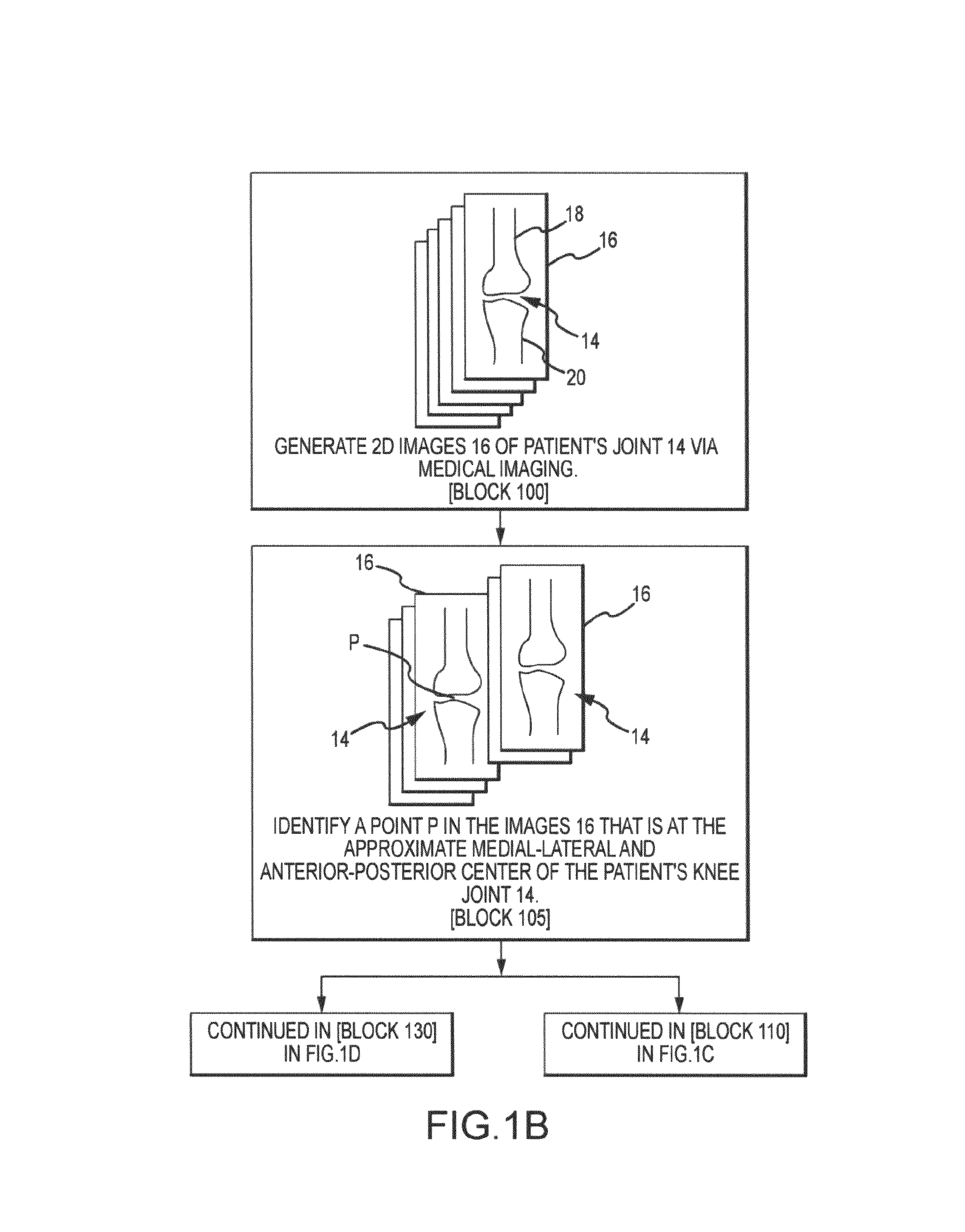 System and method for image segmentation in generating computer models of a joint to undergo arthroplasty