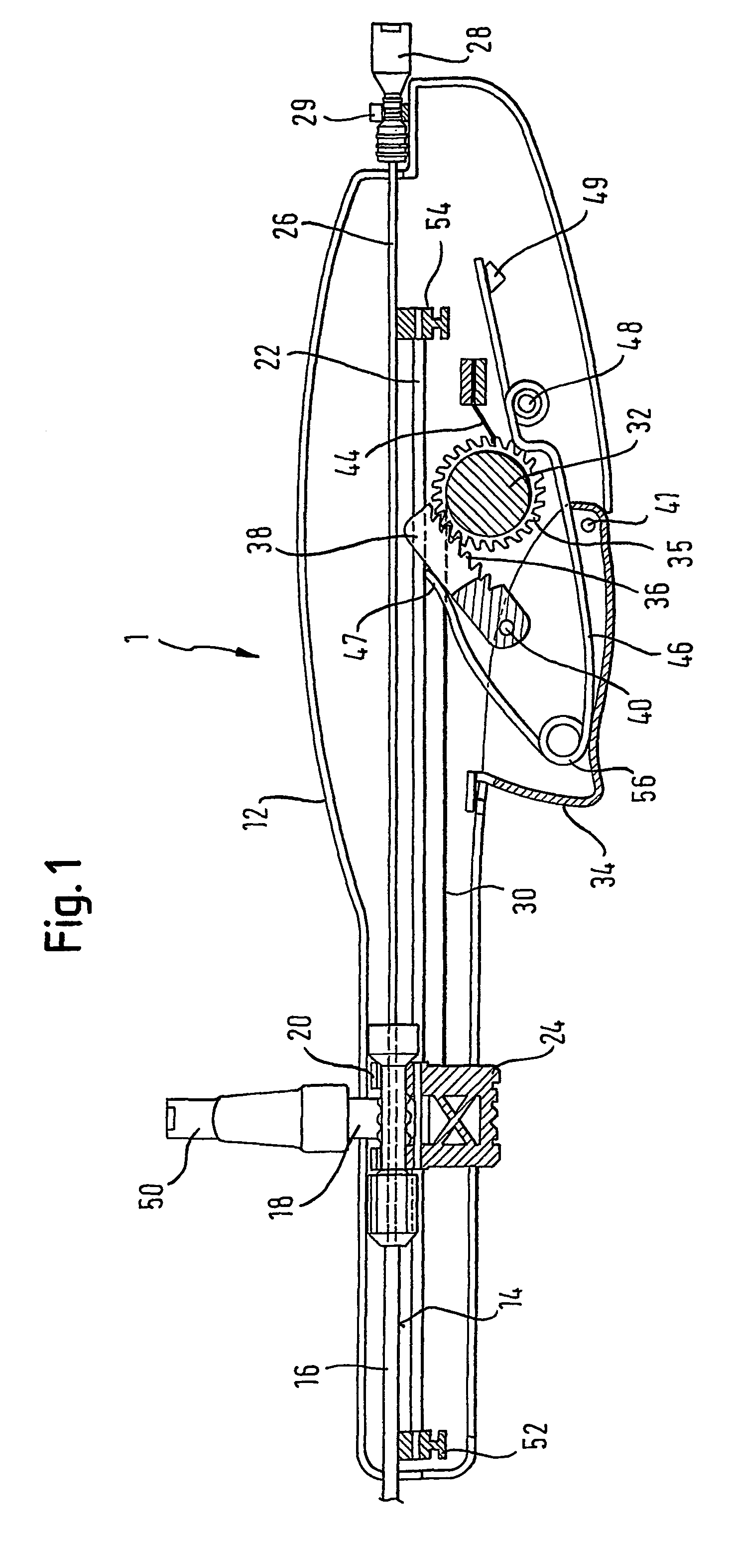 Stent delivery device and method for stent delivery