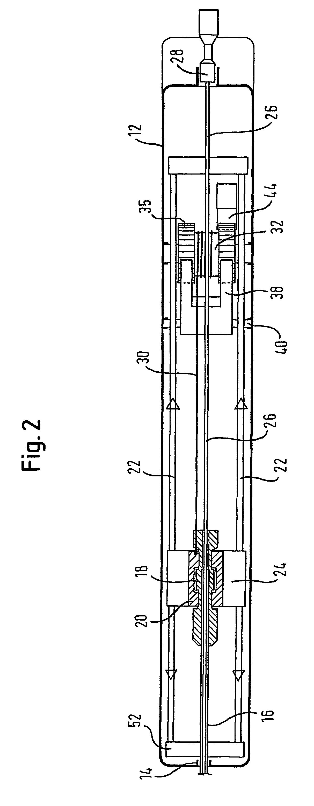Stent delivery device and method for stent delivery