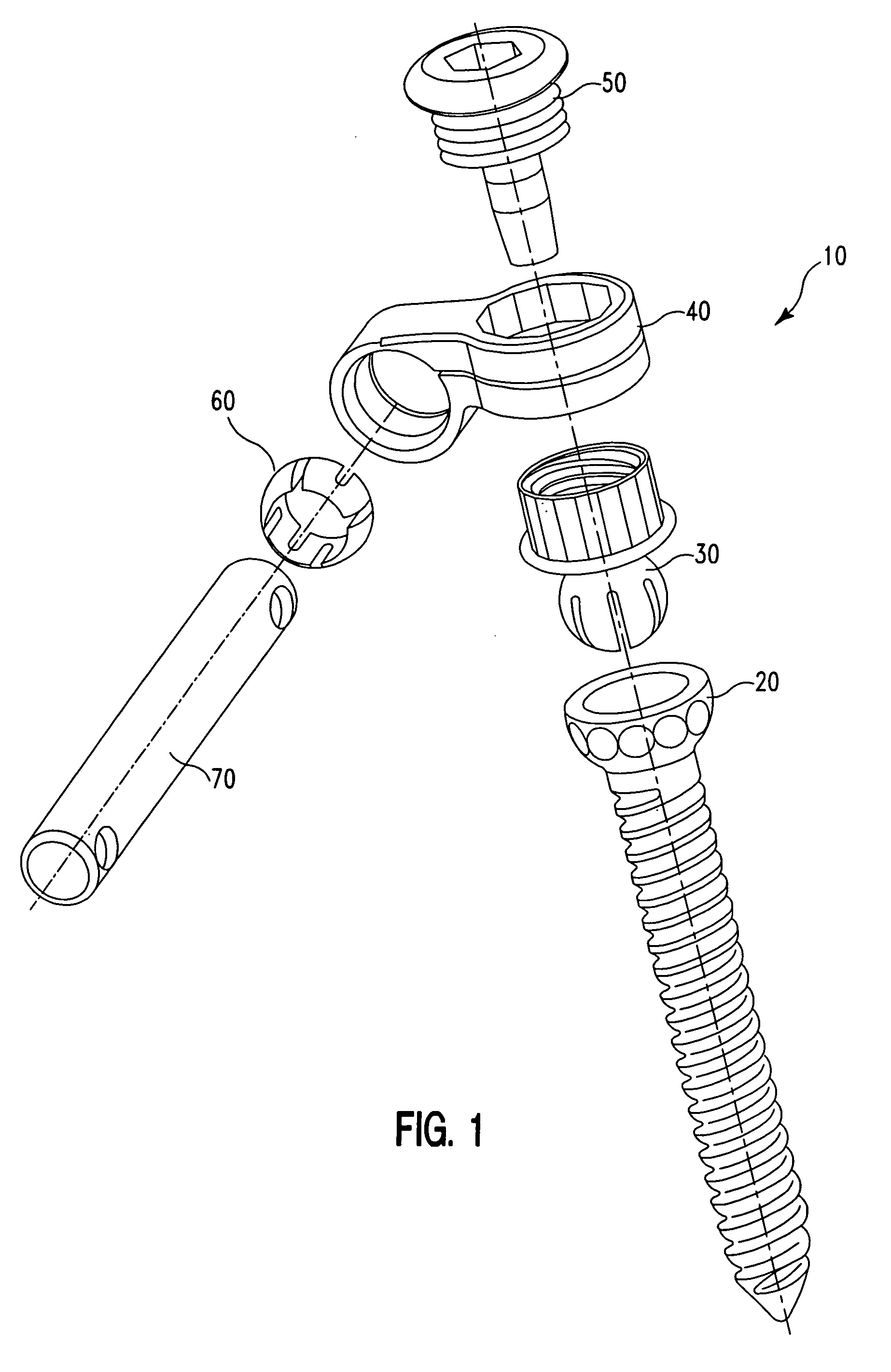 Medialised rod pedicle screw assembly