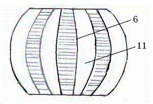 Support device for treating ONFH (osteonecrosis of femeral head)