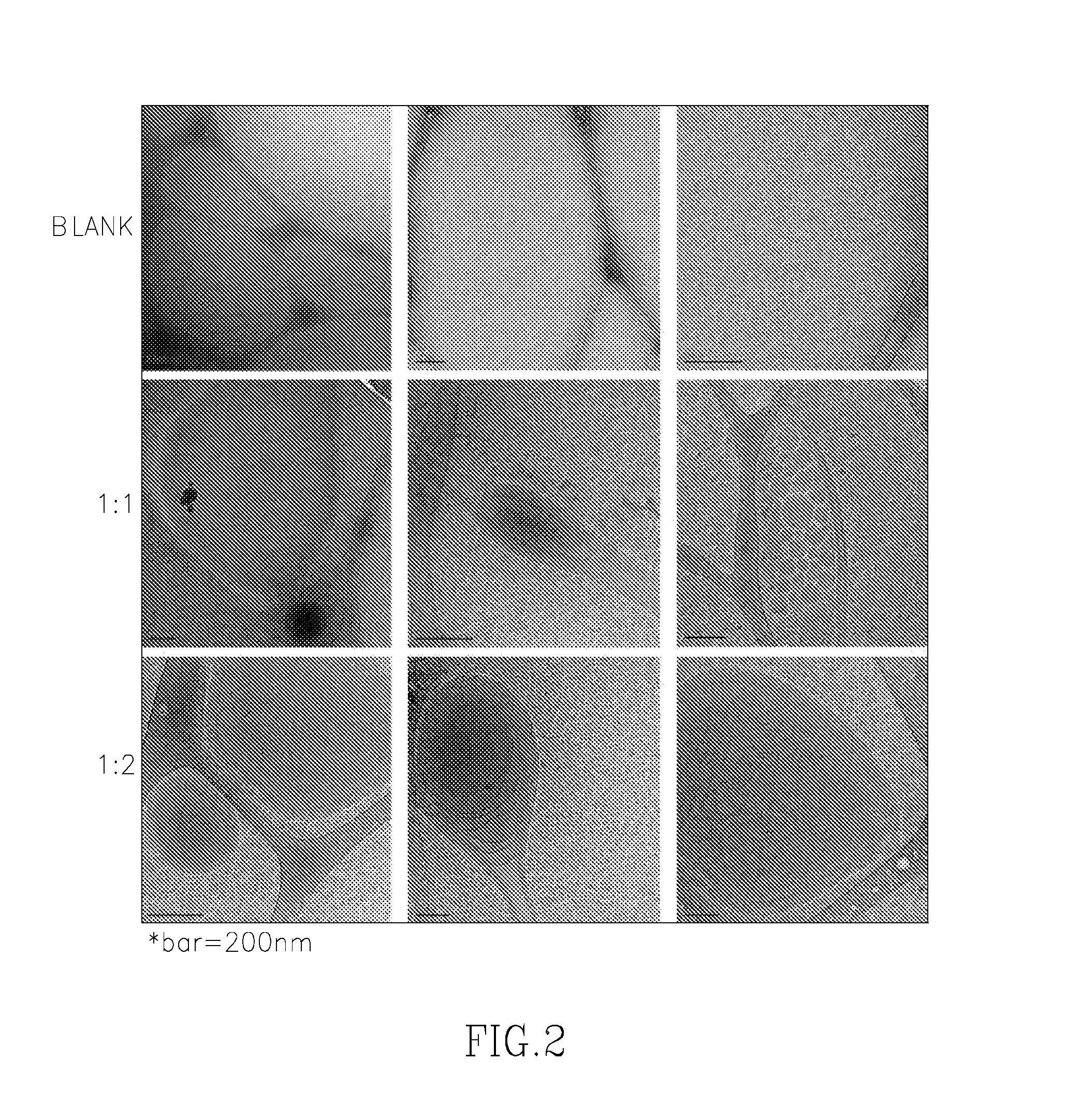 Depot Formulations of a Local Anesthetic and Methods for Preparation Thereof