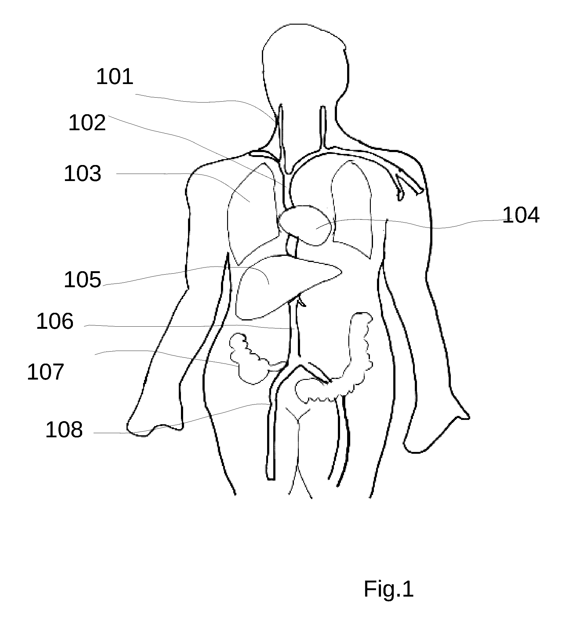 System and method for treating hepatic area vein occlusion