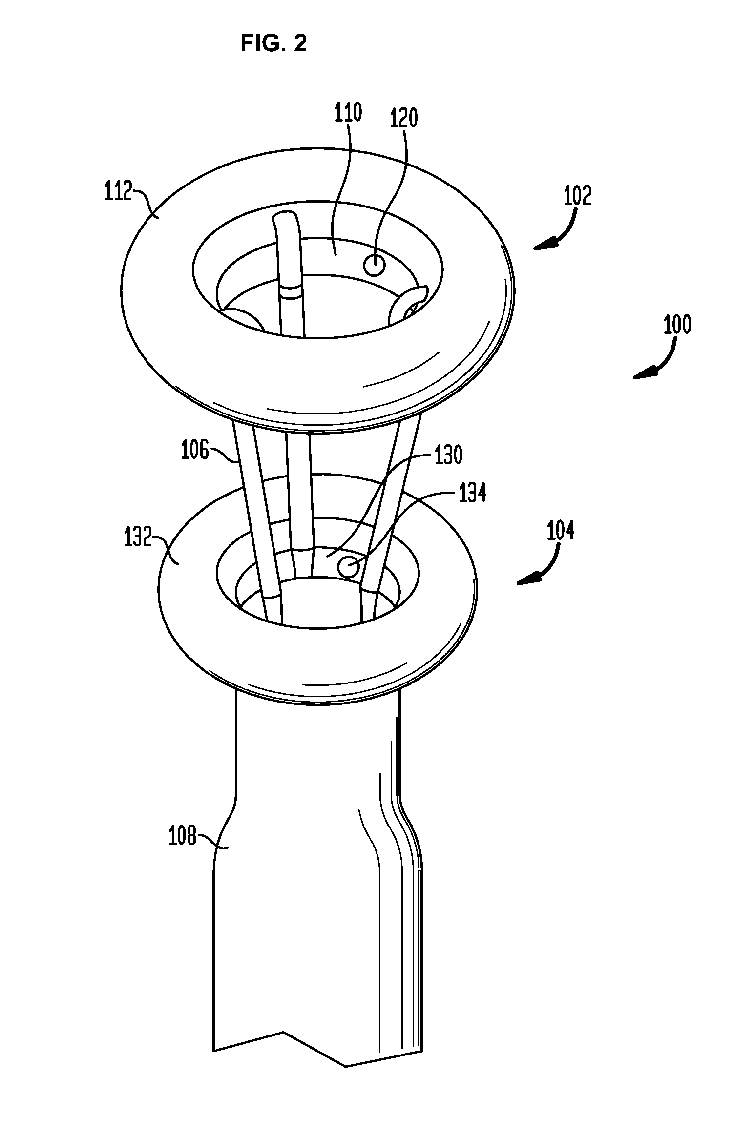 Systems and methods for treatment of obesity and type 2 diabetes