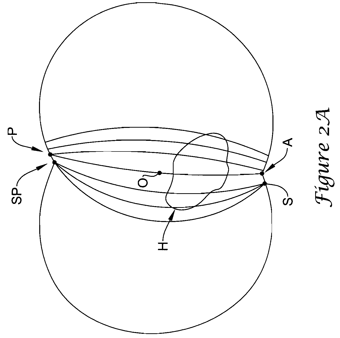 Subcutaneous implantable cardioverter-defibrillator placement methods