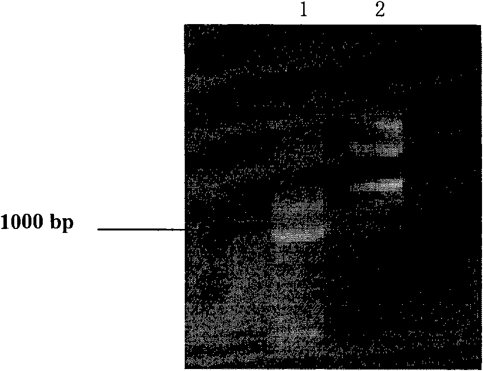 DNA for high-level expression of N-acyl homoserine lactonase in yeasts and engineering bacteria constructed thereby