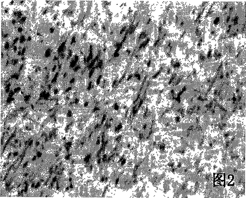 Production method of extracellular matrix engineered catheter containing olfactory ensheathing cells