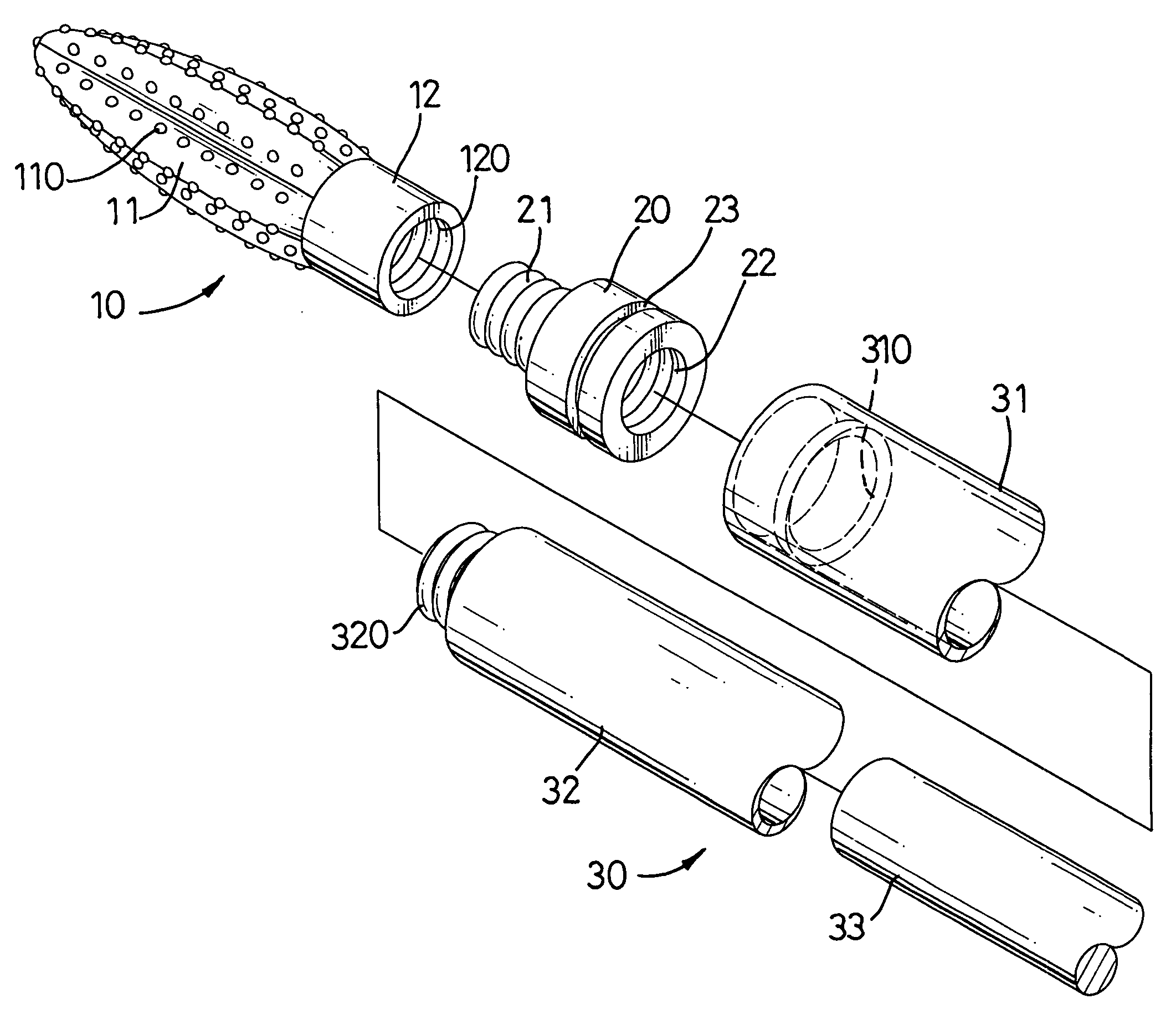 Auxiliary bone reinforcement structure