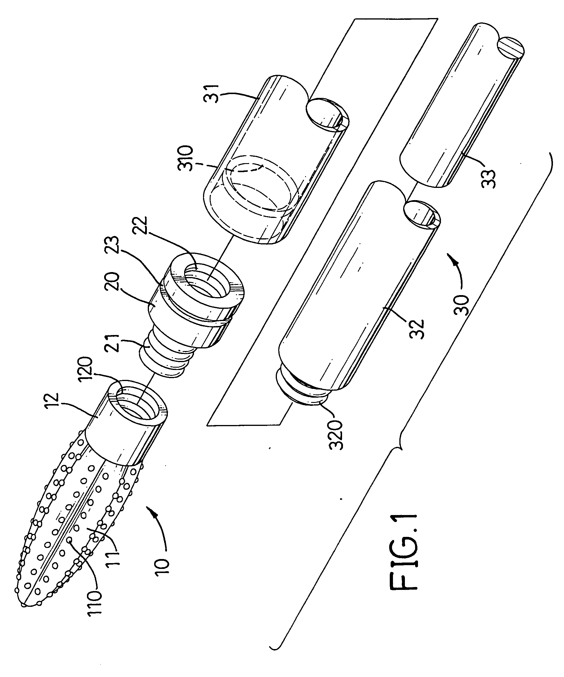 Auxiliary bone reinforcement structure