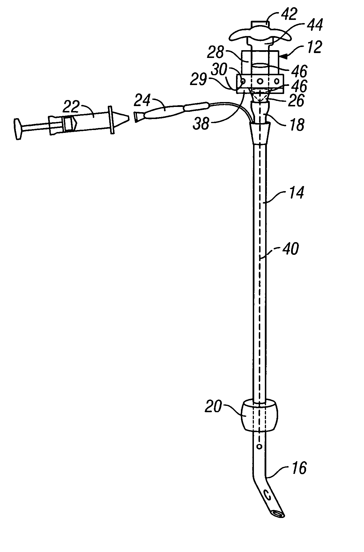 Endotracheal tube system and method of use