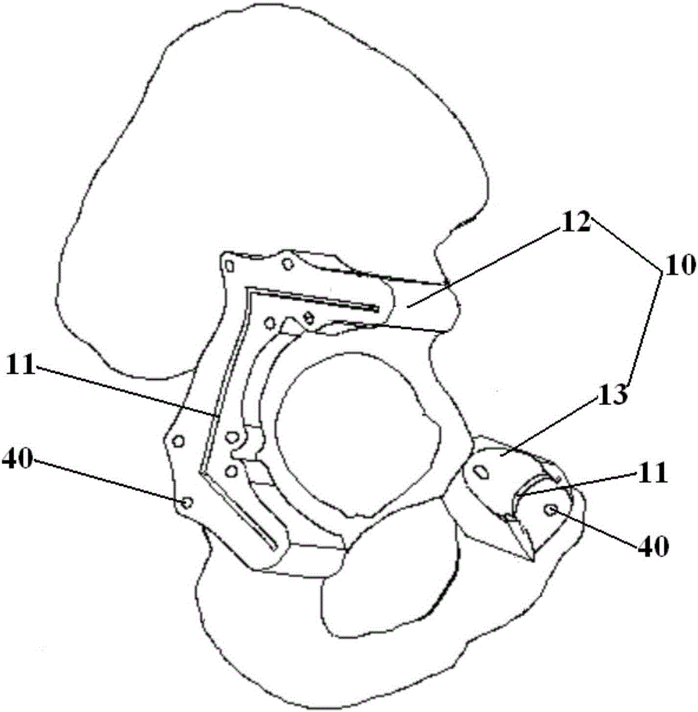 Osteotomy guide plate assembly