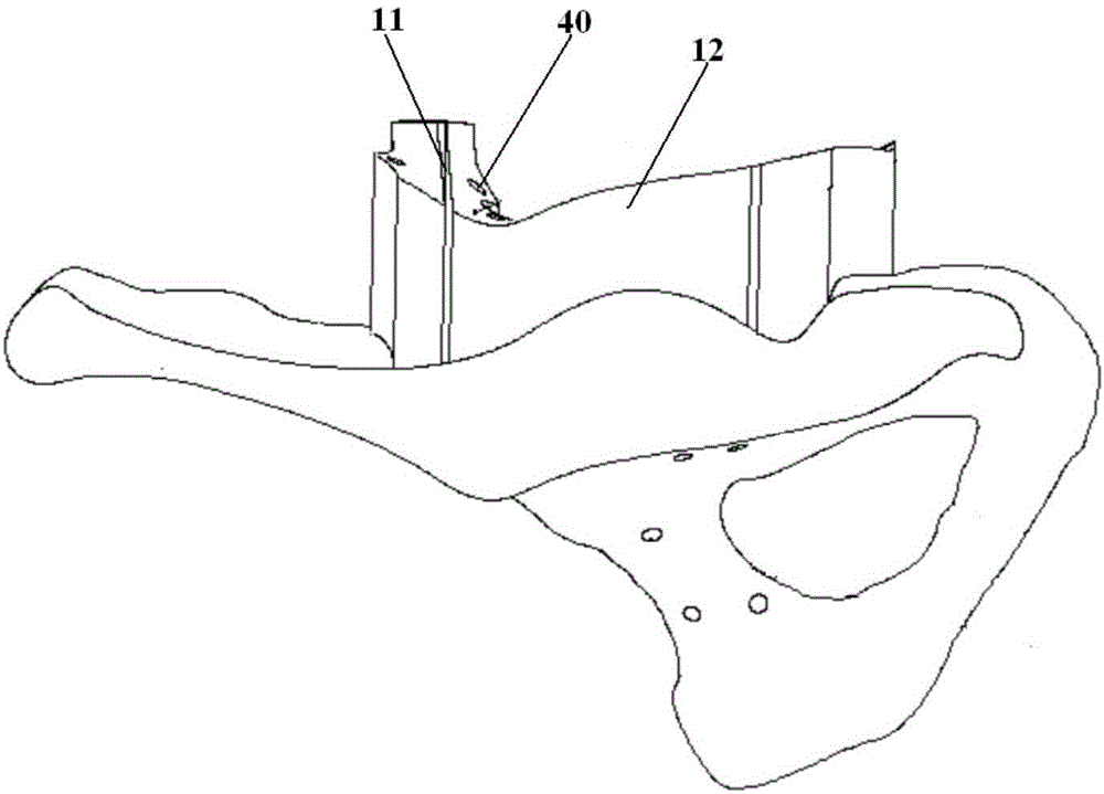 Osteotomy guide plate assembly