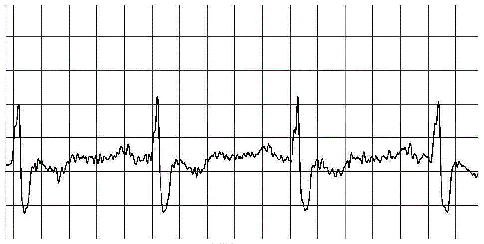 A ECG data analysis method suitable for mobile platforms