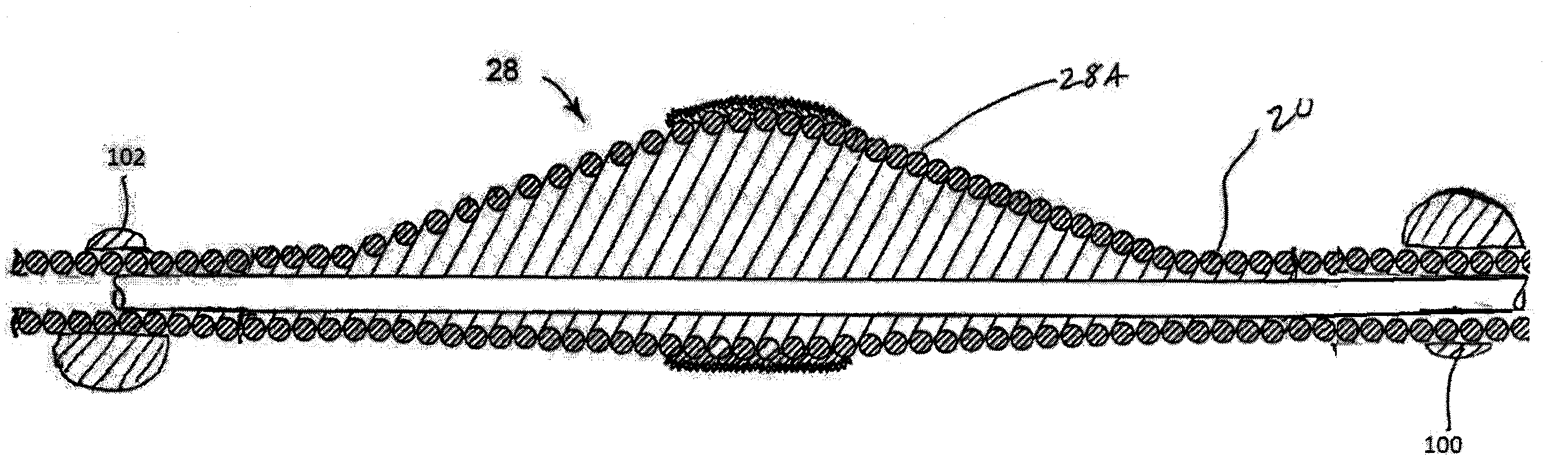 Rotational atherectomy device with counterweighting