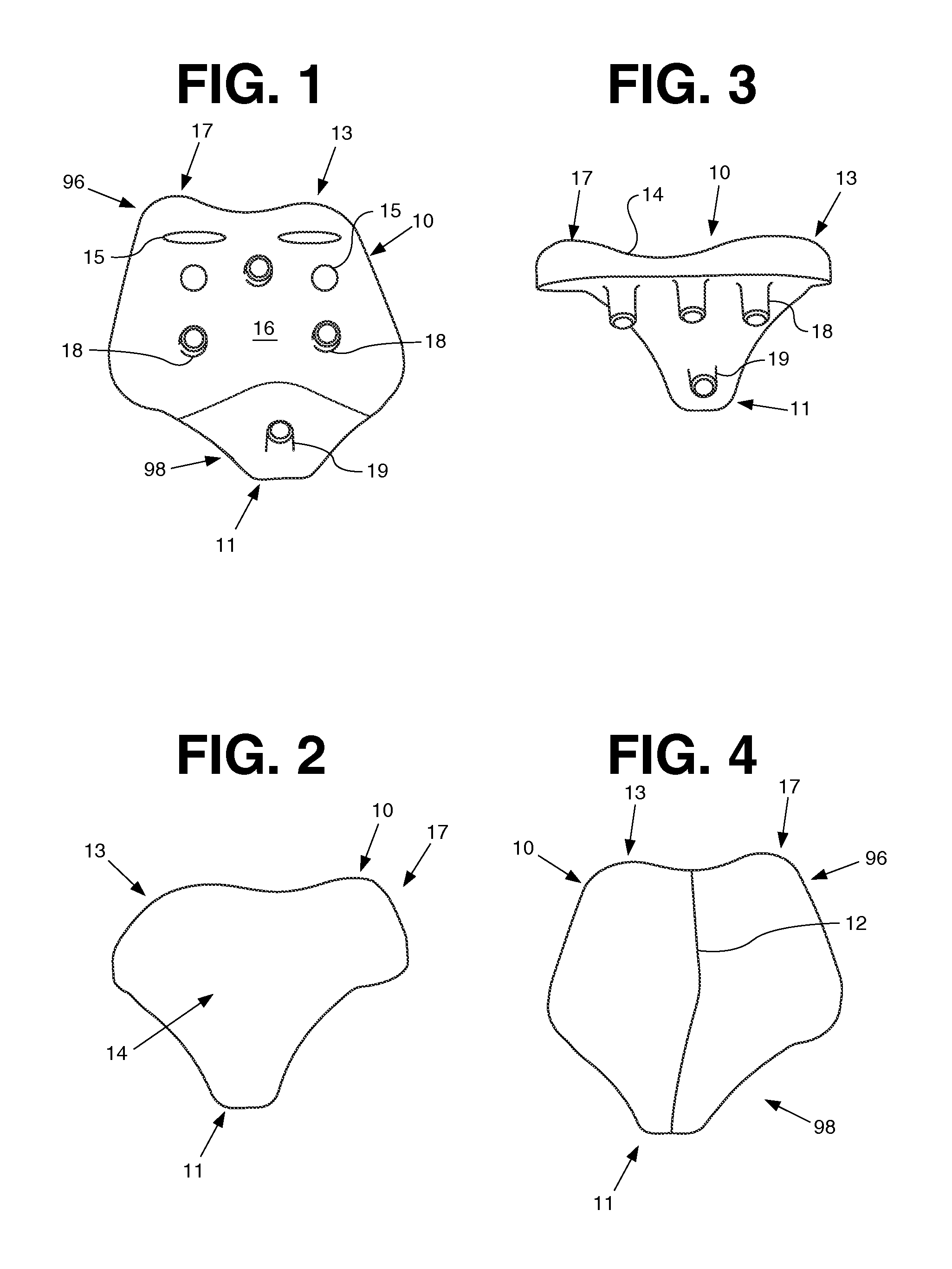 Patello-femoral joint implant and instrumentation