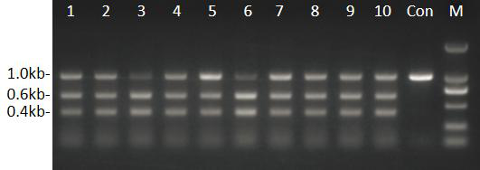 A construction method and application of an inducible b-cell deficient mouse model