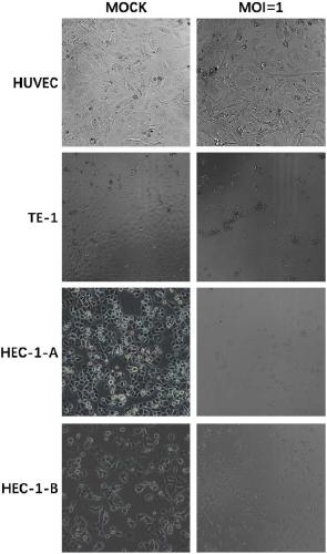 ECHO virus for treating tumors