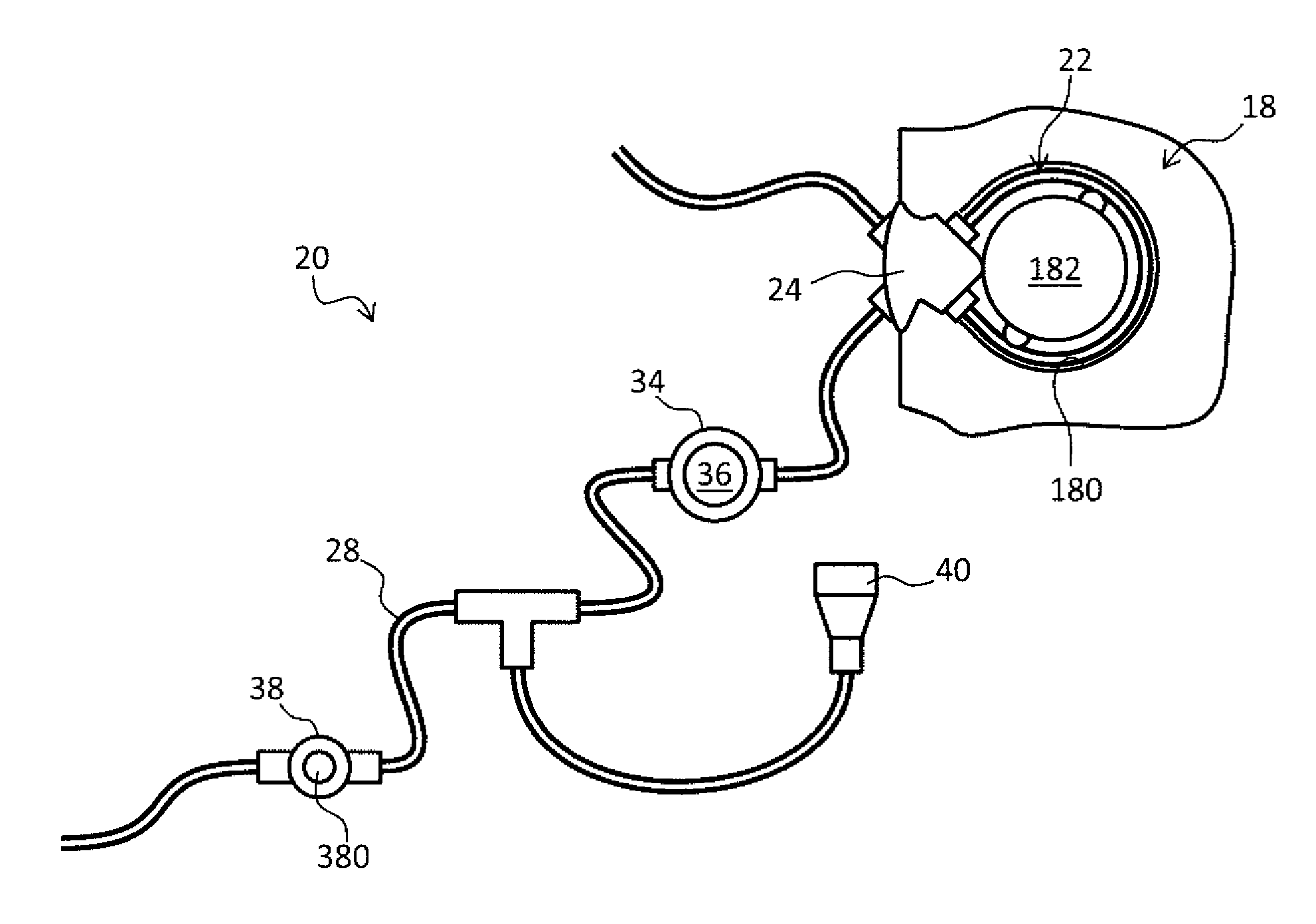 Tube for extra-corporeal circuit with double connector