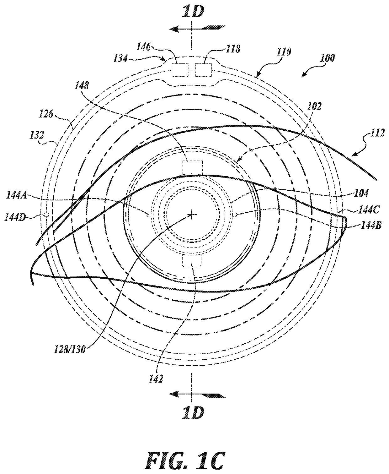 Ophthalmic system including accommodating intraocular lens and remote component and related methods of use