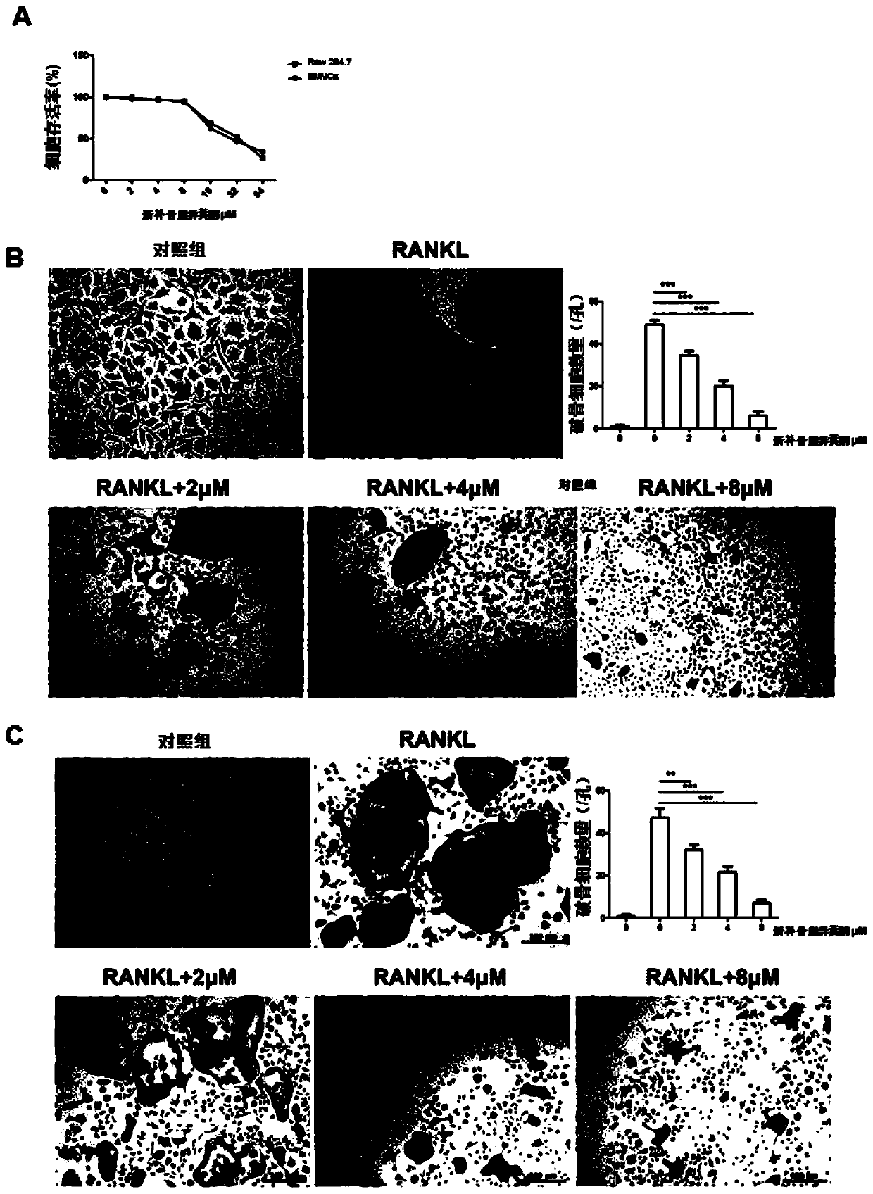 Application of novel psoralea corylifolia isoflavone in preparation of medicines for preventing or treating postmenopausal osteoporosis