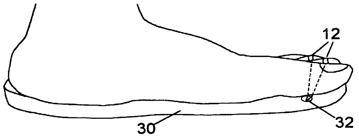 Arrangement for monitoring physiological signals