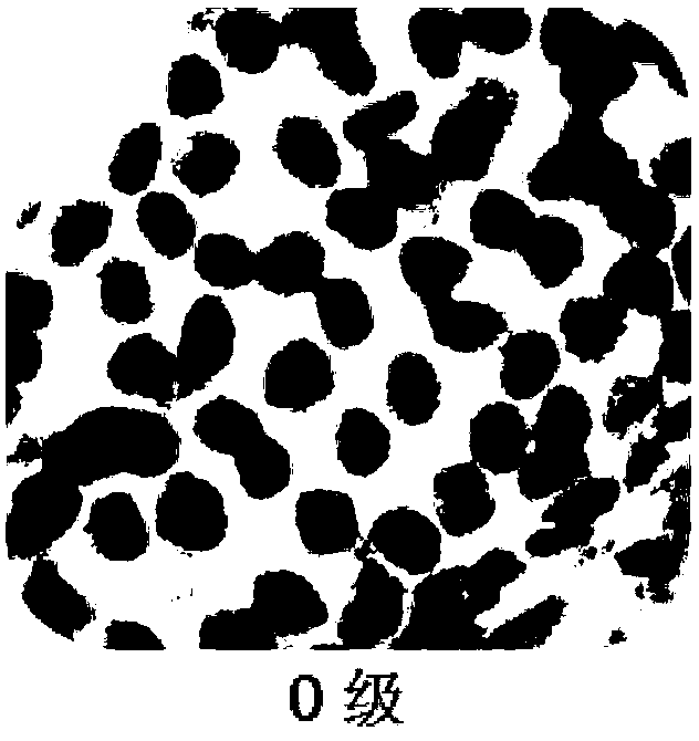 Grading model for detecting benign and malignant degrees of skin tumors and application thereof