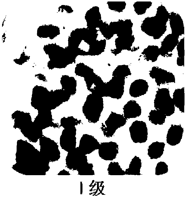 Grading model for detecting benign and malignant degrees of skin tumors and application thereof