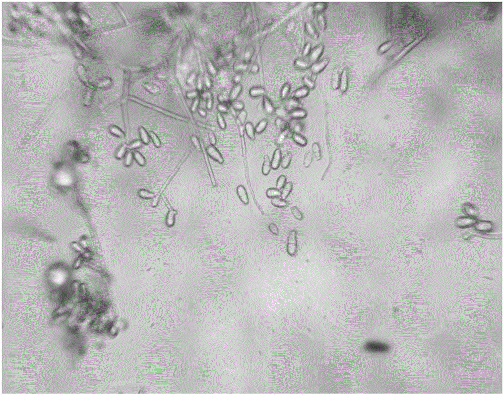 Application of Trichothecium roseum TR-1 and fermented product to prevention and treatment of wheat powdery mildew