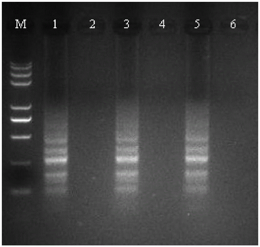 Ring isothermal amplification primers capable of fast detecting pratylenchus neglectus and application thereof