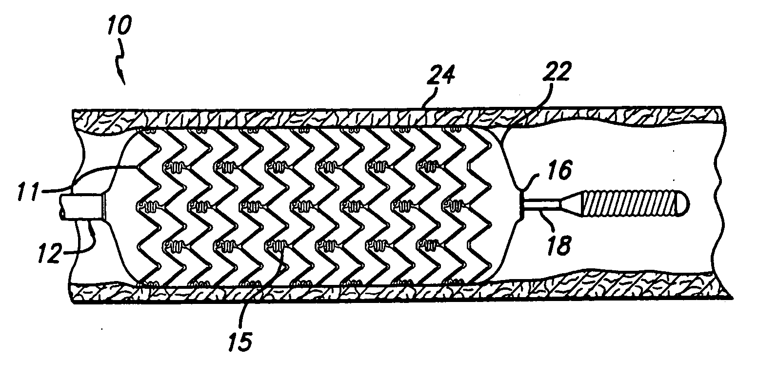 Treatment Of Diabetic Patients With A Drug Eluting Stent And Adjunctive Therapy