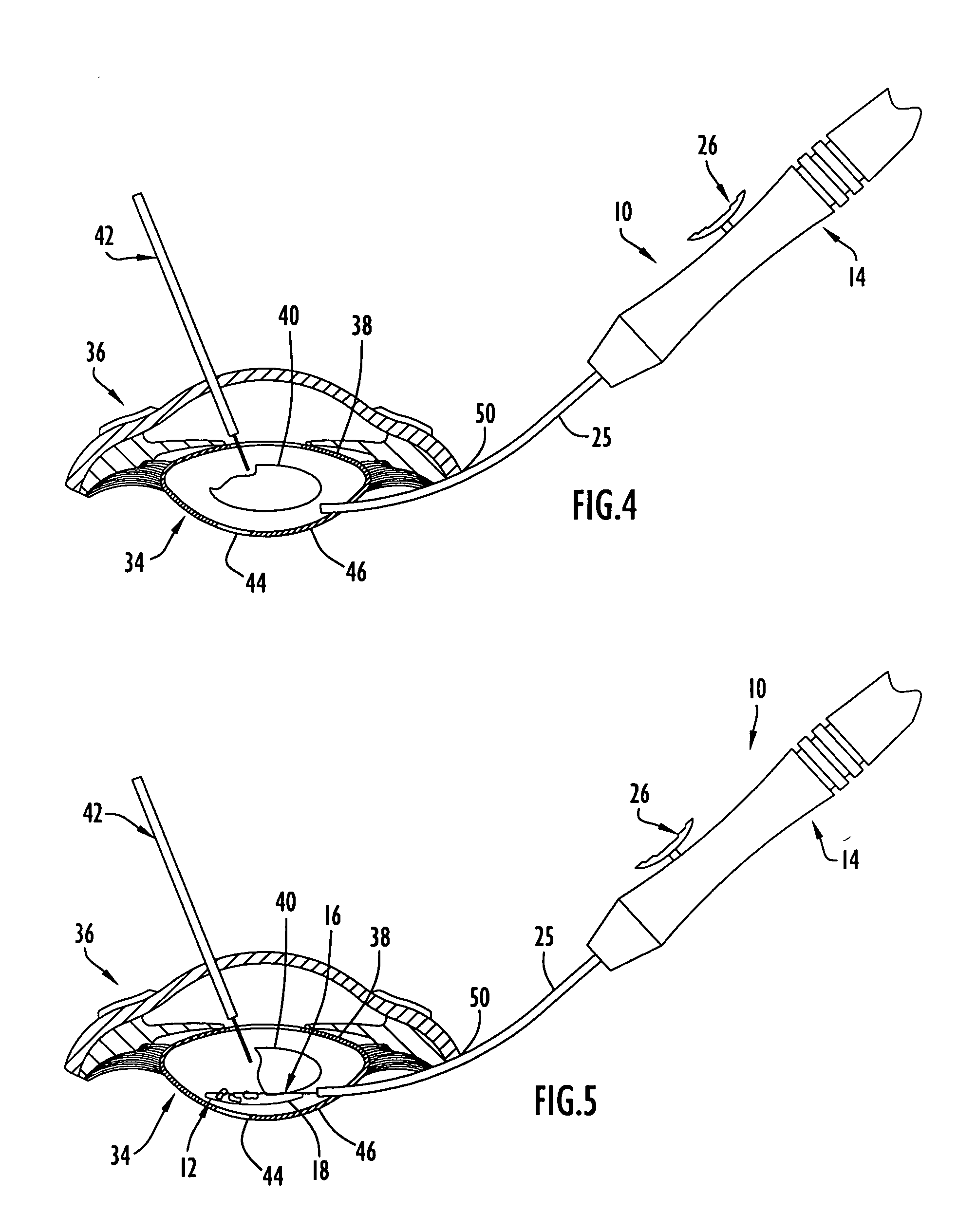 Lenticular net instruments