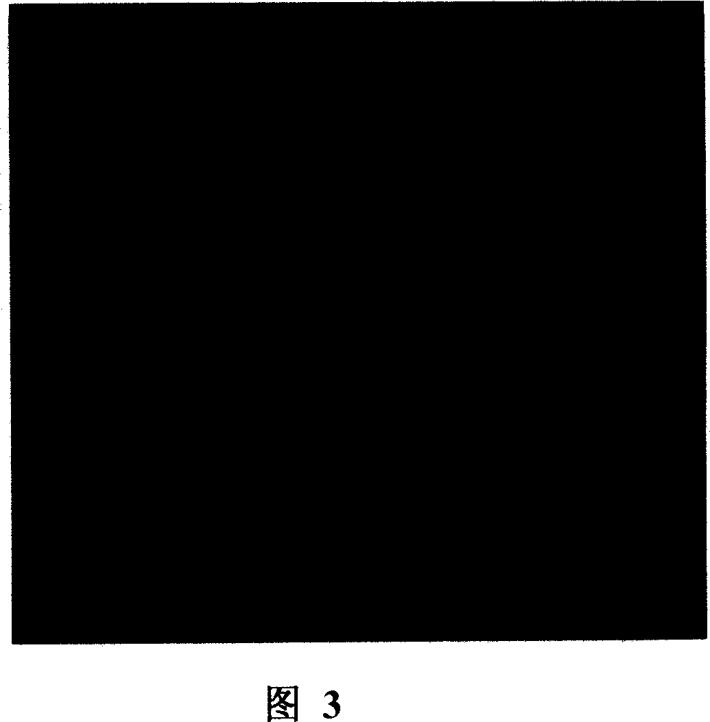 Application of resorcin compound for preparing antitumor medicine