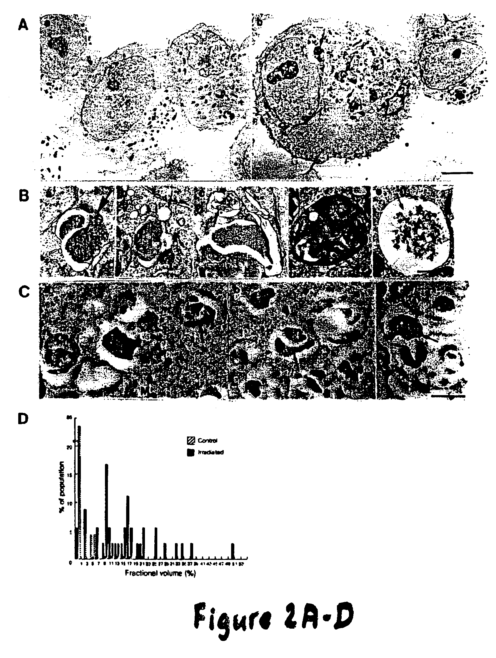 Inhibition of vacuolar proton ATPase activity and/or the modulation of acidic organelle function sensitizes cells to radiation, chemotherapy and biological agents