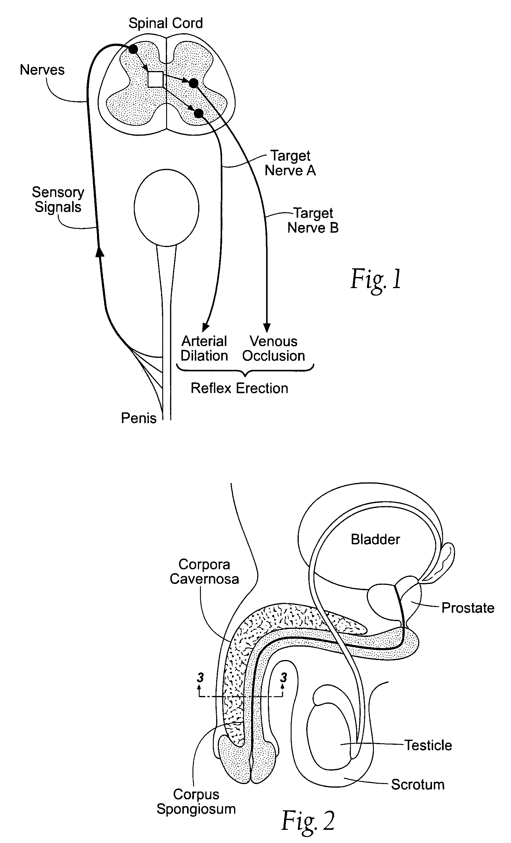 Systems and methods of neuromodulation stimulation for the restoration of sexual function