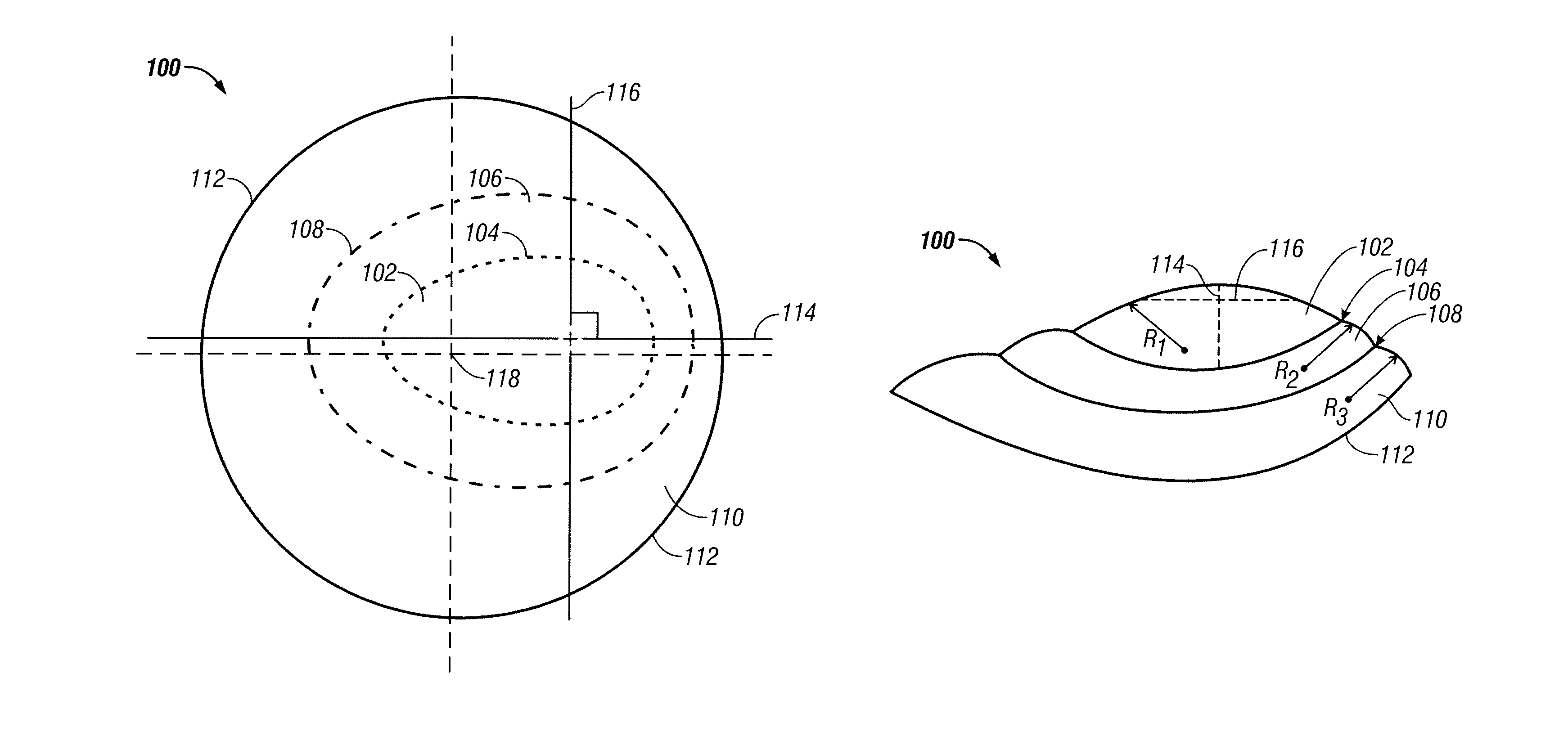 Contact lens for keratoconus