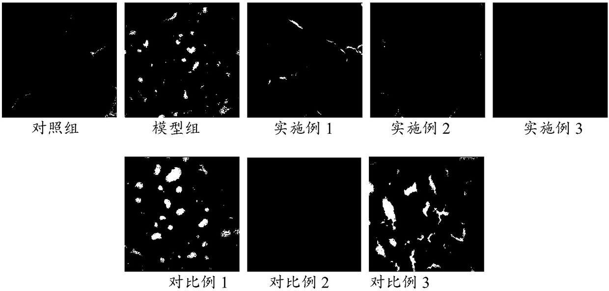 Composition for alleviating thyroid nodules and hypothyroidism and application thereof