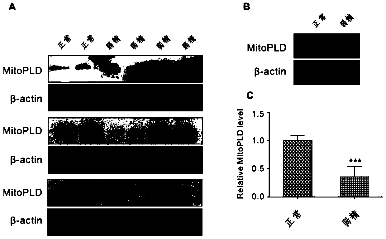 A combination of sperm pirna markers associated with male reproductive dysfunction and its application