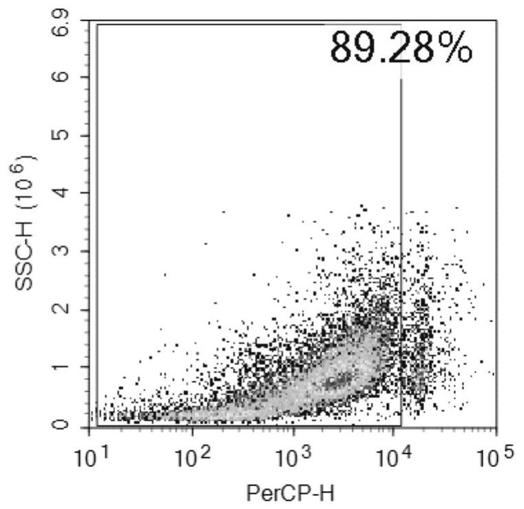 Urine protein marker for asthma and application thereof